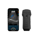 Ultrasonograf bezprzewodowy na telefon 