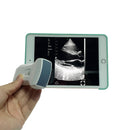 Ultrasonograf MICRO WiFi