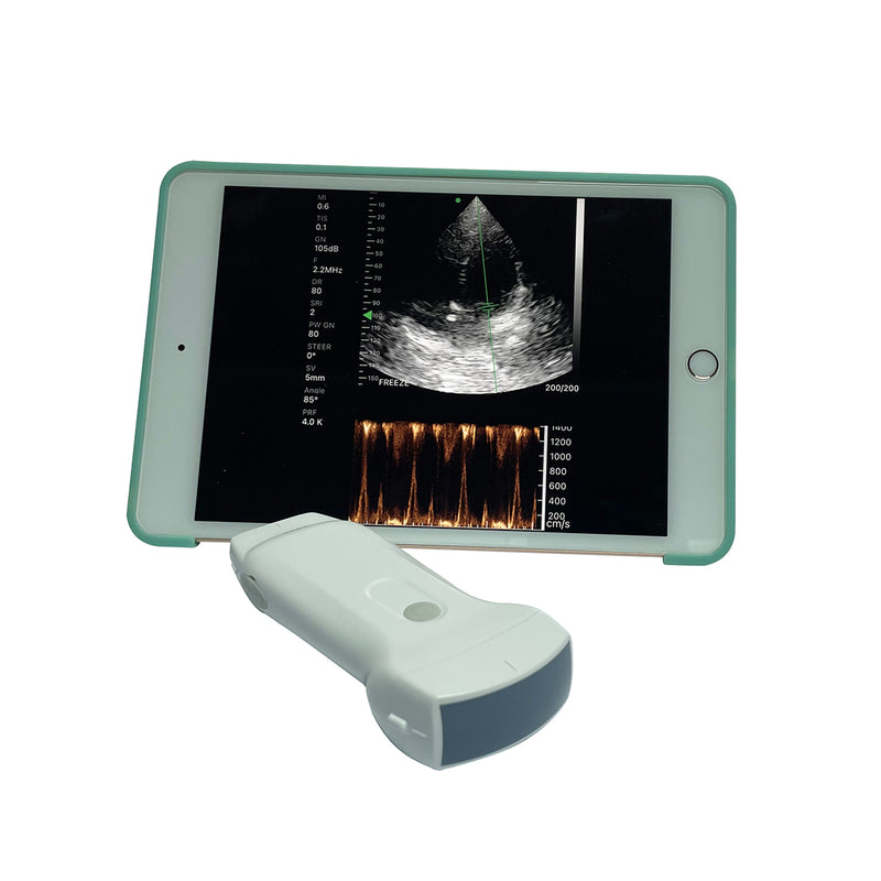 Ultrasonograf MICRO WiFi