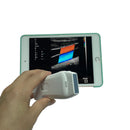 Ultrasonograf MICRO WiFi
