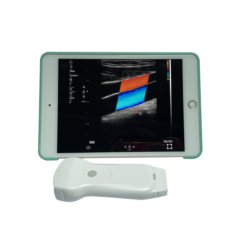 Ultrasonograf MICRO WiFi