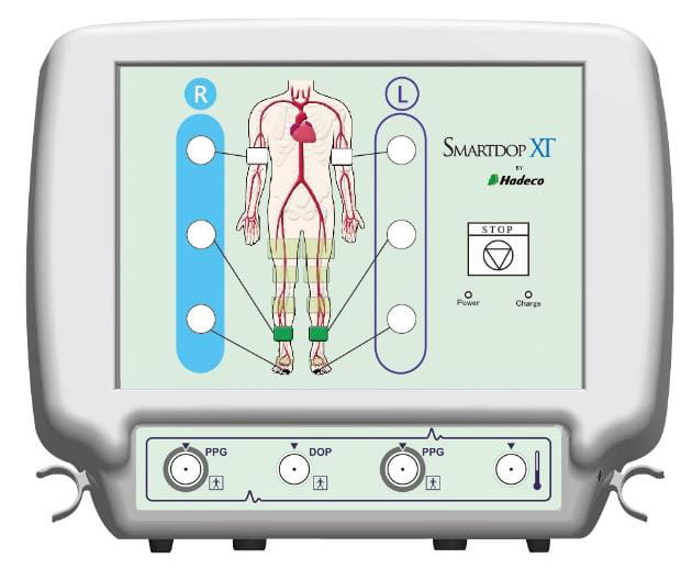 Hadeco-Smartdop-XT---6-punktowe-pełne-badanie-naczyniowe--ABI,-TBI,--PVR