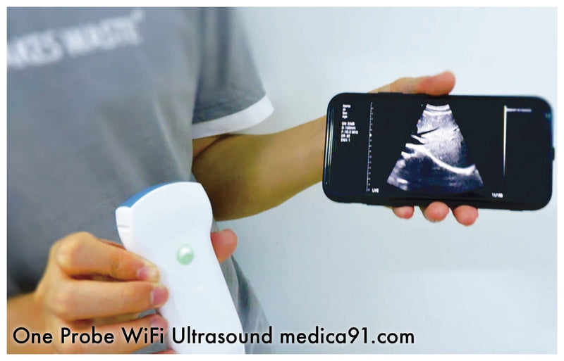 Ultrasonograf-WiFi-C10T-USG-3-in-1-Probe-Color-Doppler-WiFi-bezprzewodowe-uniwersalne--MOBILNE-USG