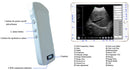 Ultrasonograf-C10-CT-color-doppler-WiFi-convex--bezprzewodowe-potęczne-USG-POCUS-sonda-192-elementów