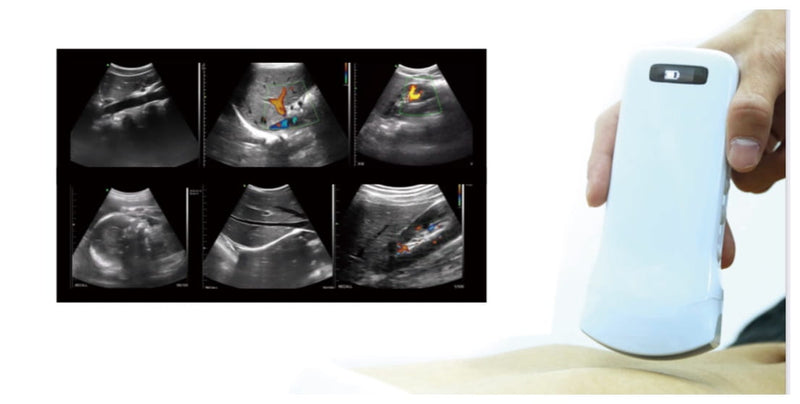 Ultrasonograf-C10-CT-color-doppler-WiFi-convex--bezprzewodowe-potęczne-USG-POCUS-sonda-192-elementów