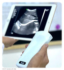 Ultrasonograf-C10-CT-color-doppler-WiFi-convex--bezprzewodowe-potęczne-USG-POCUS-sonda-192-elementów