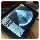 Usg Kosmos w trakcie przeprowadzania badania abdomen