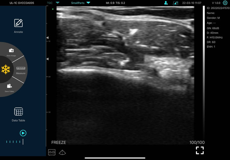 Gen4 Pro C10CS POCUS USG sonda WiFi Kolor 10-14mhz