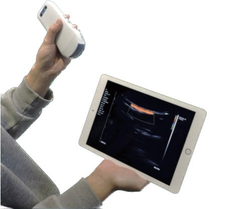 Ultrasonograf WiFi C10T MyUSG 3 in 1 Color Doppler Przenośne USG